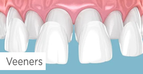 Veeners
