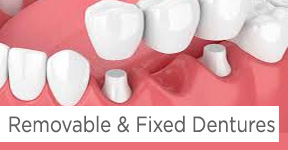 Removable and fixed Dentures